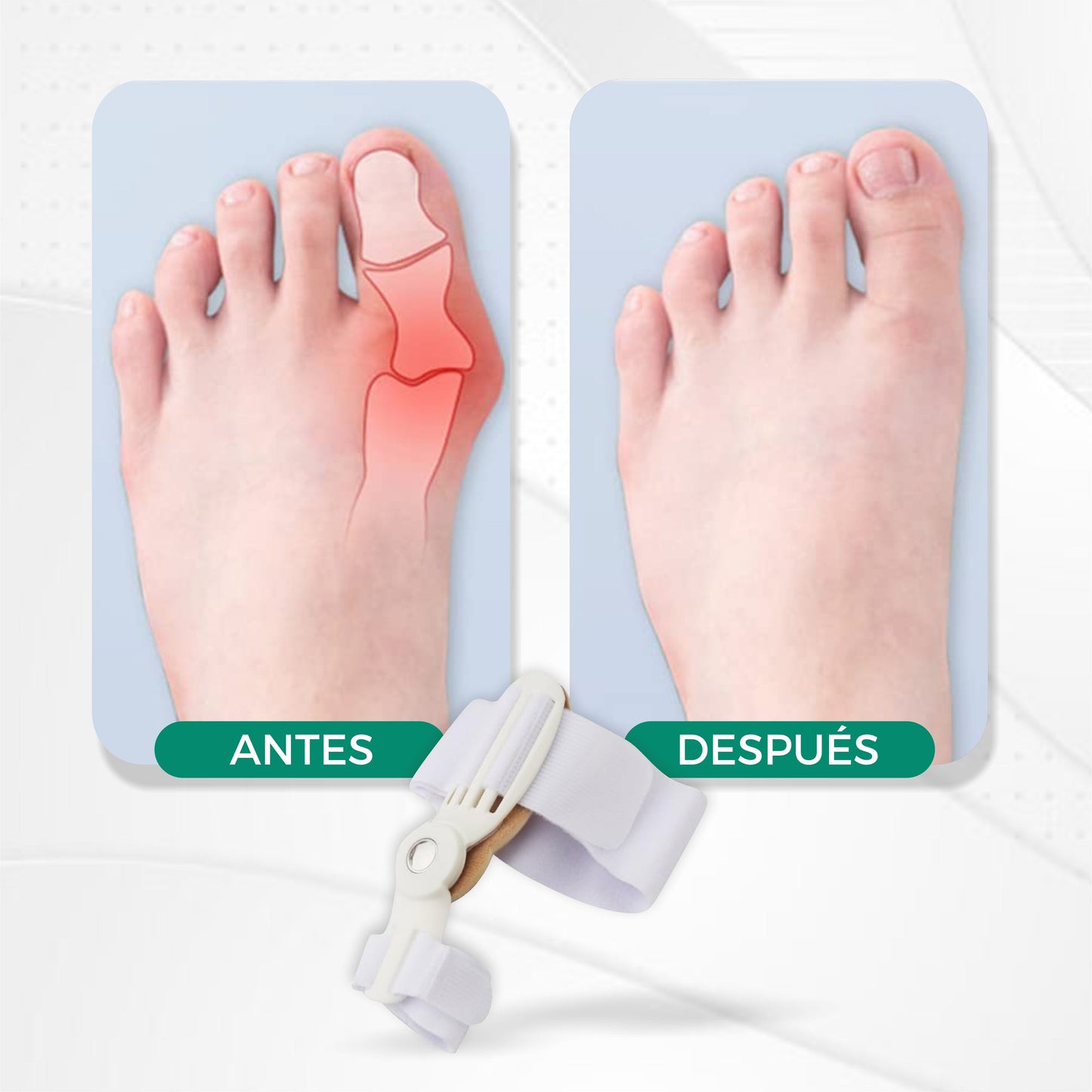 Corrector Profesional De Juanetes - ErgoToes©