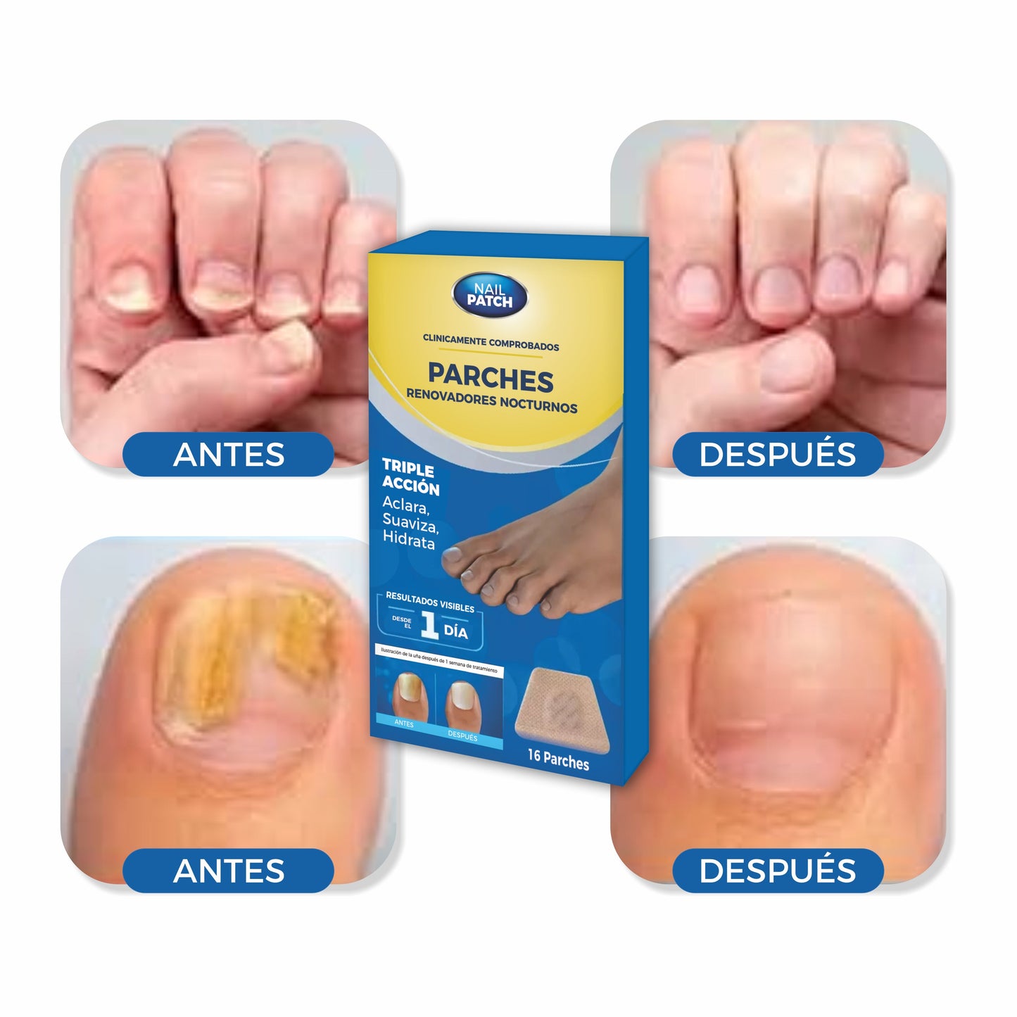 2x1 Parches AntiHongos y Regeneradores De Uñas - NailPatch®