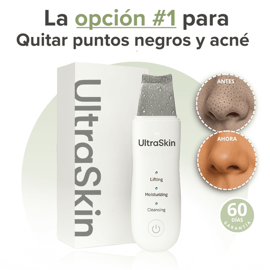 Espatula Ultrasonica Elimina Puntos Negros y Acné - ULTRASKIN