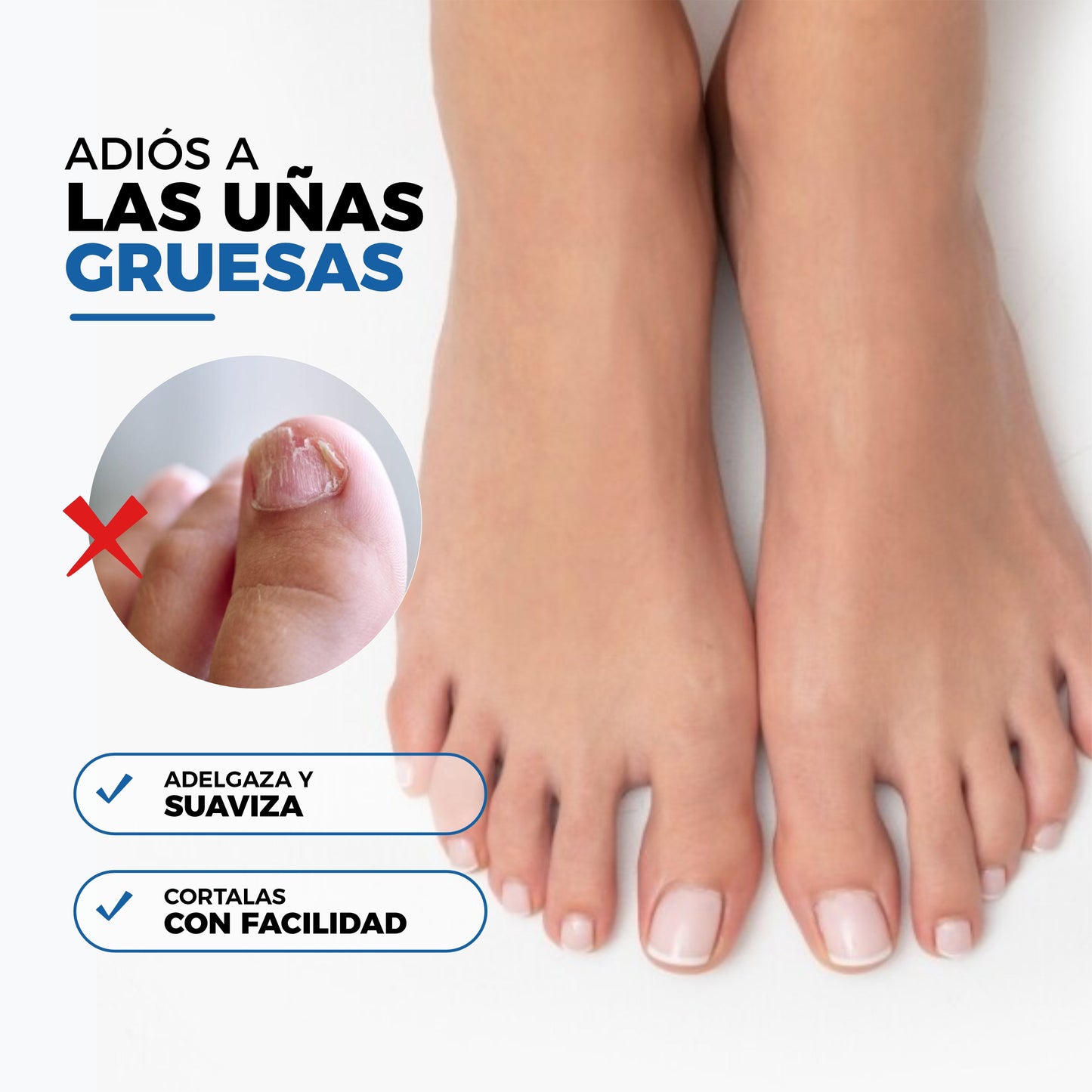 2x1 Parches AntiHongos y Regeneradores De Uñas - NailPatch®